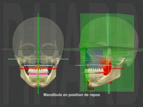 Face Morpho-Positional Diagnosis