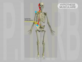 DAM Adaptatif Majeur : Posture Gnrale Pathologique