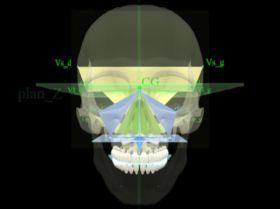 Presentation of maxillary indicators