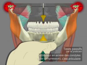 Mandibular tests differential Muscular-Articular 