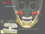 Mastication Fonctionnelle