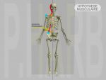 DAM Adaptatif Majeur : Posture Gnrale Pathologique