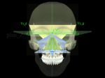 Presentation of mandibular indicators
